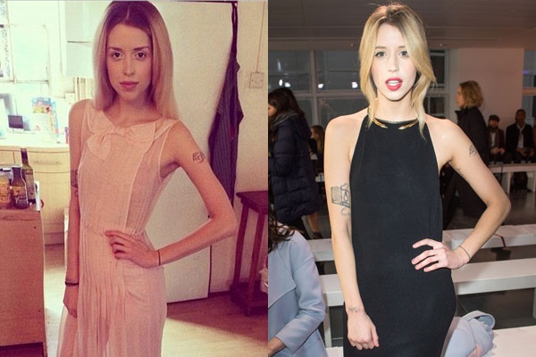 Peaches Geldof, beautiful skinny mother of two. Dead person. Coincidence?